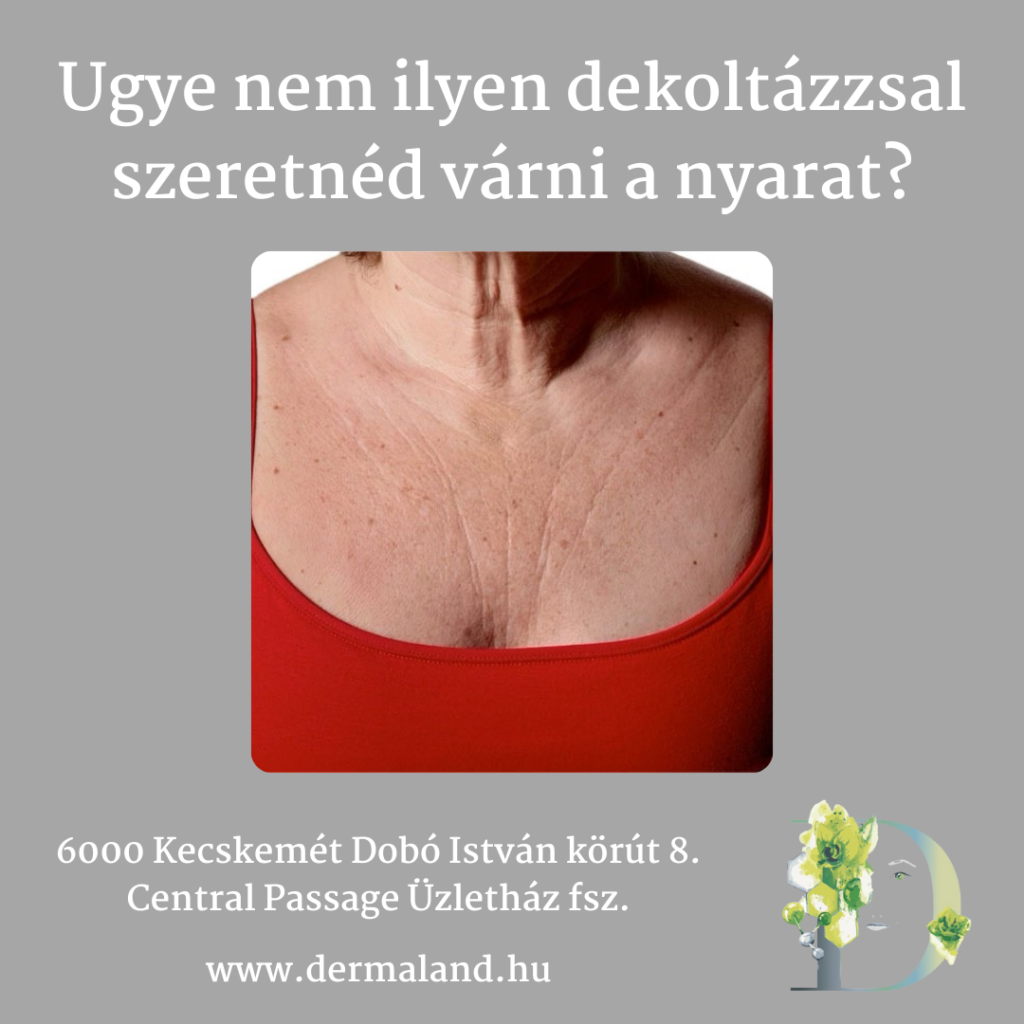 mezoterápia, hifu, rádiófrekvenciás kezelés. bőrfiatalítás, bőrmegújítás, antiaging, kecskeméti Dermaland kozmetika, kozmetikus, nyak dekoltázs tuning